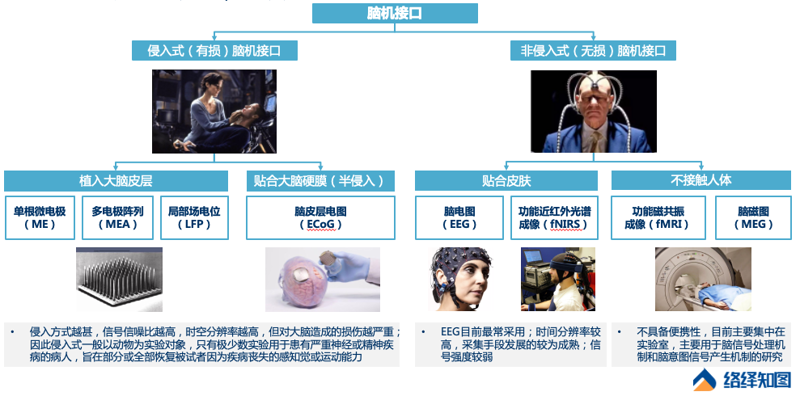 脑机接口技术：开启智能时代新篇章