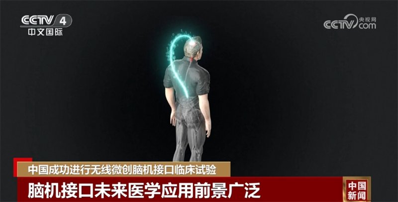 脑机接口应用